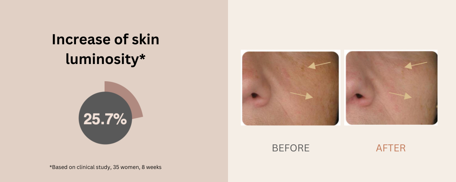 Reduce dark spots and brighten complexion benefits of Béyond Glow